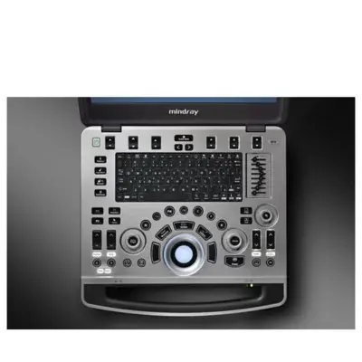 Mindray M9: A Powerful Point-of-Care Ultrasound